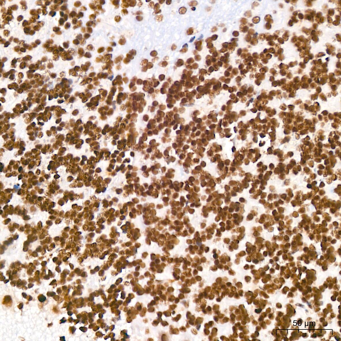 DDX17 Antibody (2U1P0)