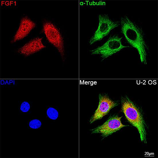 FGF acidic/FGF1 Antibody (3X3E5)