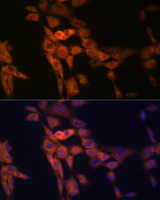 TWEAK R/TNFRSF12 Antibody (1G4T3)