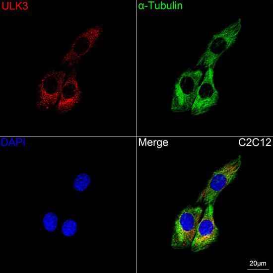 ULK3 Antibody (5Z7Z6)