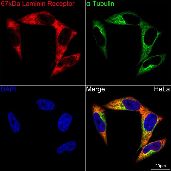 RPSA Antibody (2Q8Q6)
