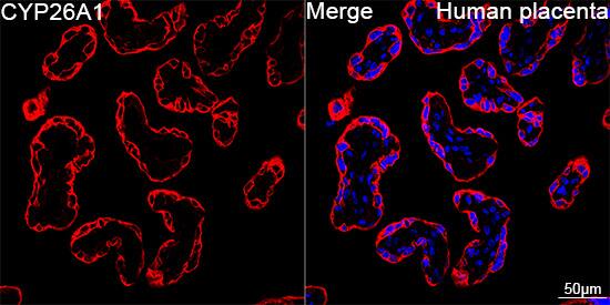 CYP26A1 Antibody (1E1D2)
