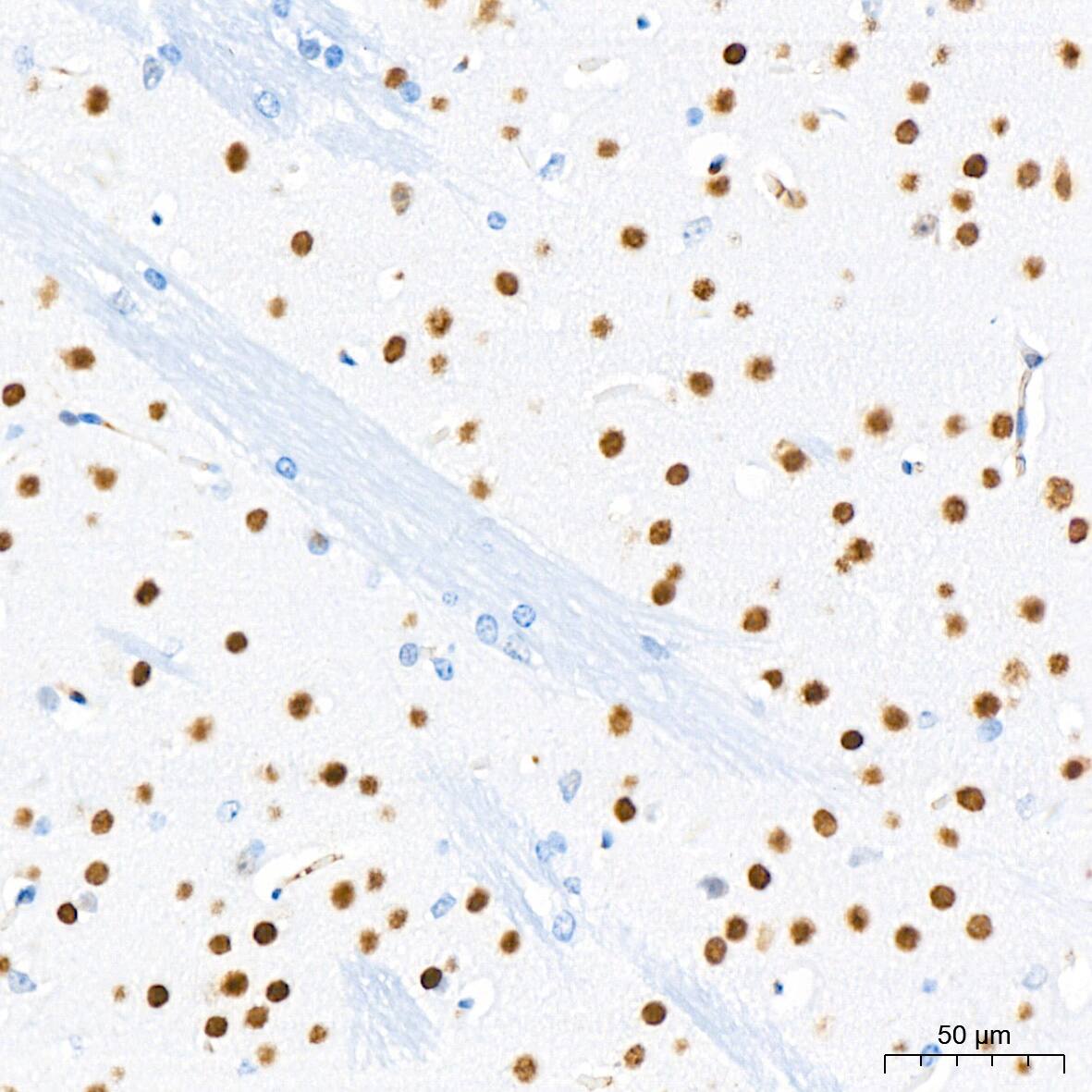 CHD3 Antibody (8Z6L6)