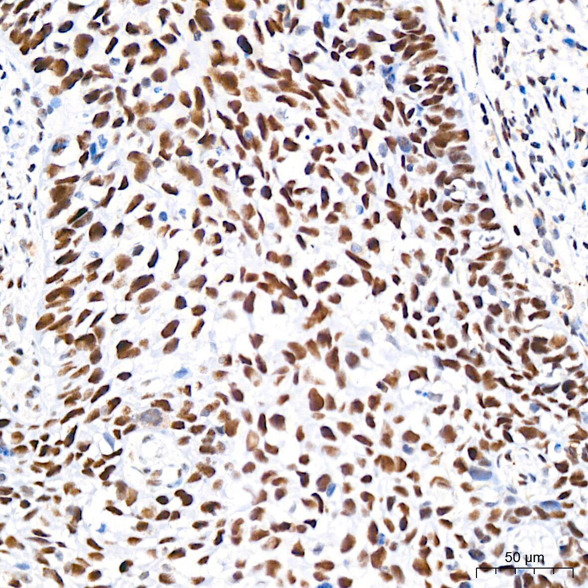 CHD3 Antibody (8Z6L6)