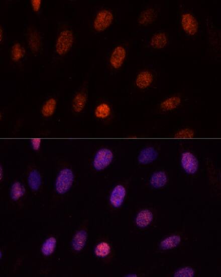 PCGF1 Antibody - Azide and BSA Free