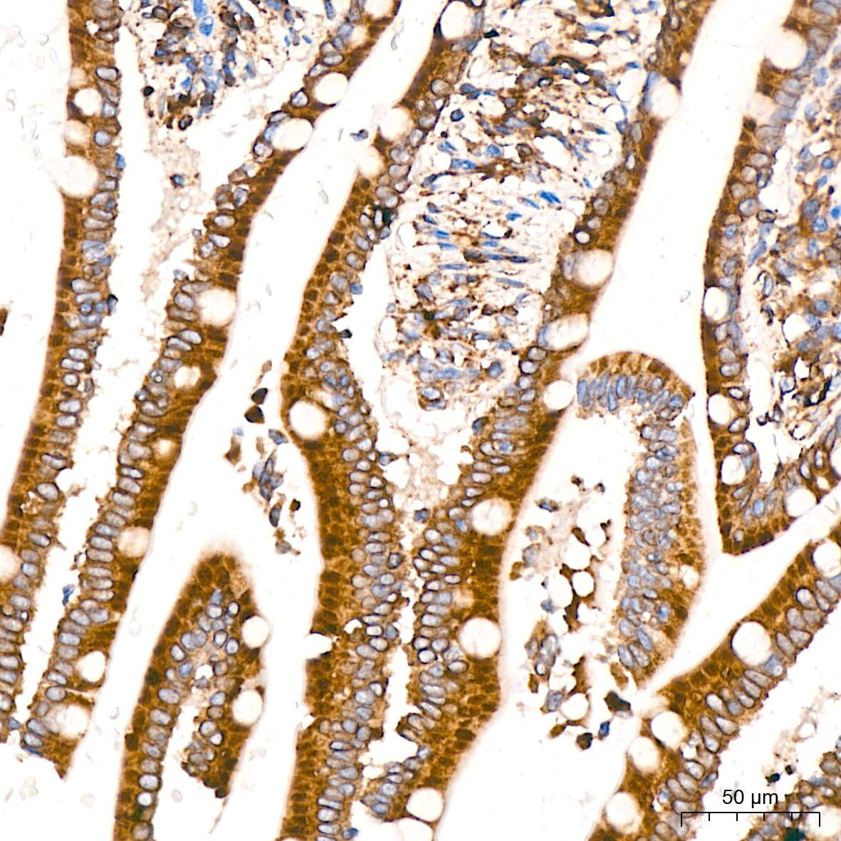 ADAM15 Antibody (4T4X10)