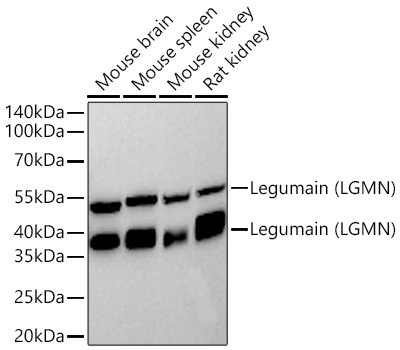 Legumain/Asparaginyl Endopeptidase Antibody (6X5U6)