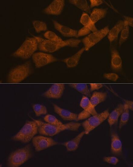 KIF3A Antibody (1C8K4)