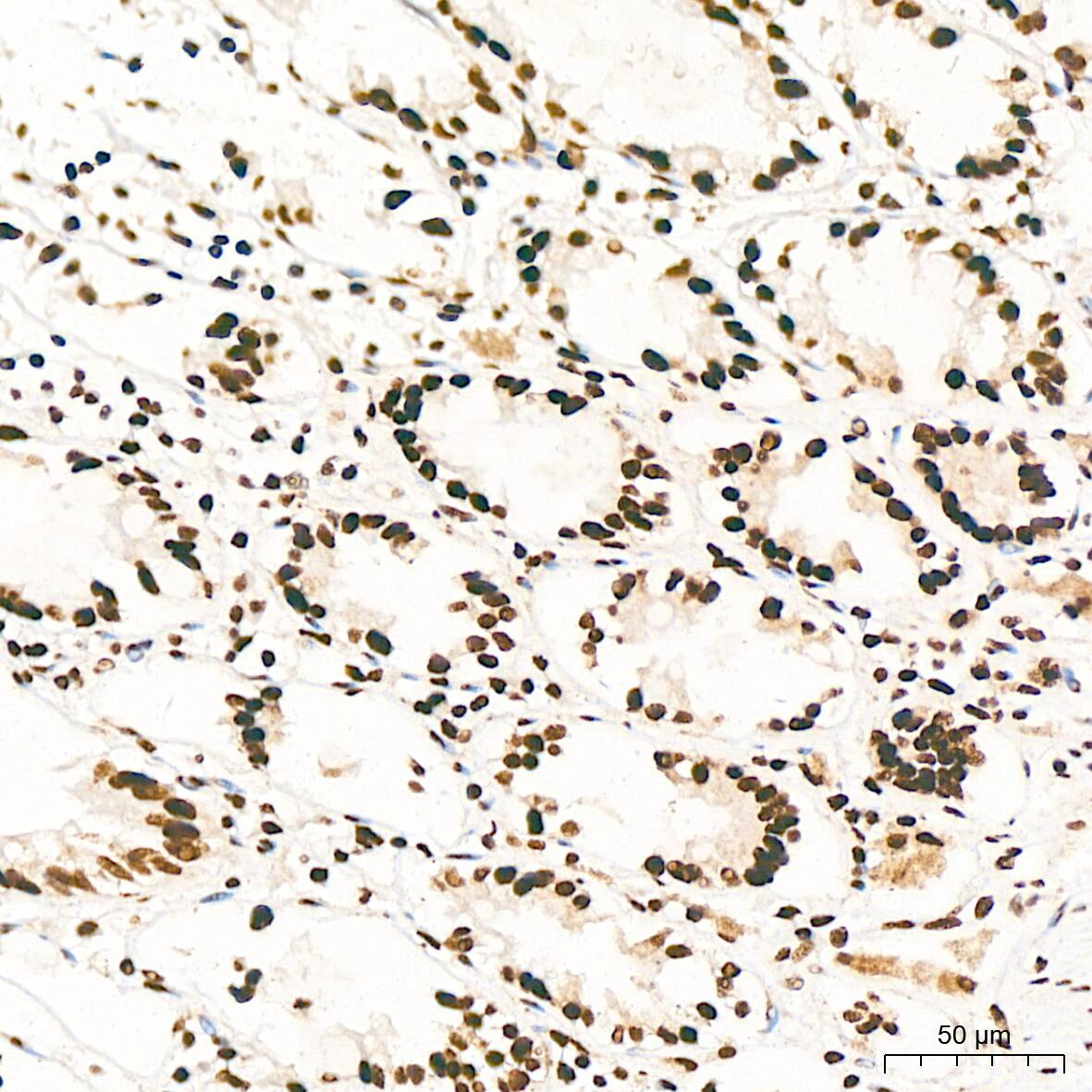 ILF3 Antibody (0S2N7)