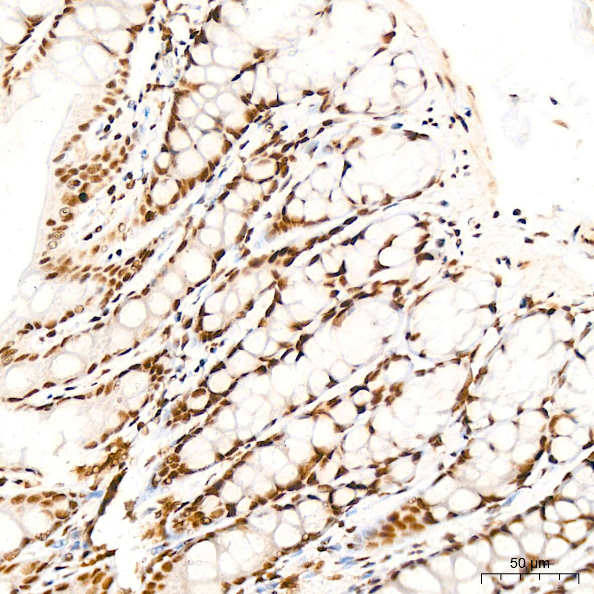 ILF3 Antibody (0S2N7)