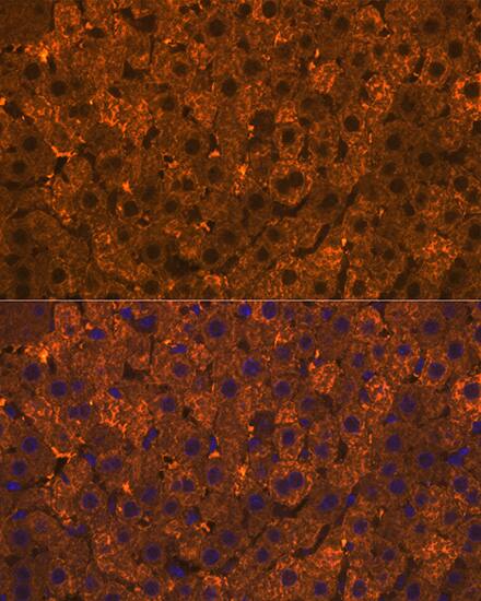 Cytosolic Sulfotransferase 2A1/SULT2A1 Antibody (4A3H6)