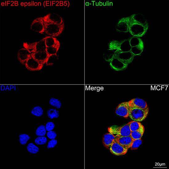 eIF2B epsilon Antibody (5M2D4)
