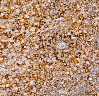 eIF2B epsilon Antibody (5M2D4)