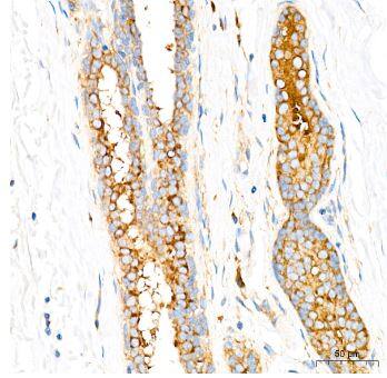 eIF2B epsilon Antibody (5M2D4)