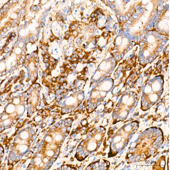 eIF2B epsilon Antibody (5M2D4)