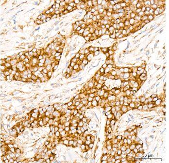 eIF2B epsilon Antibody (5M2D4)