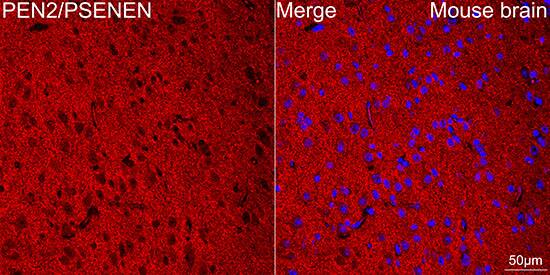 PSENEN/PEN2 Antibody (6J5O4)