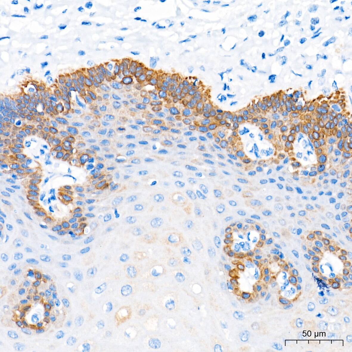 Cytokeratin 16 Antibody (8L6R4)