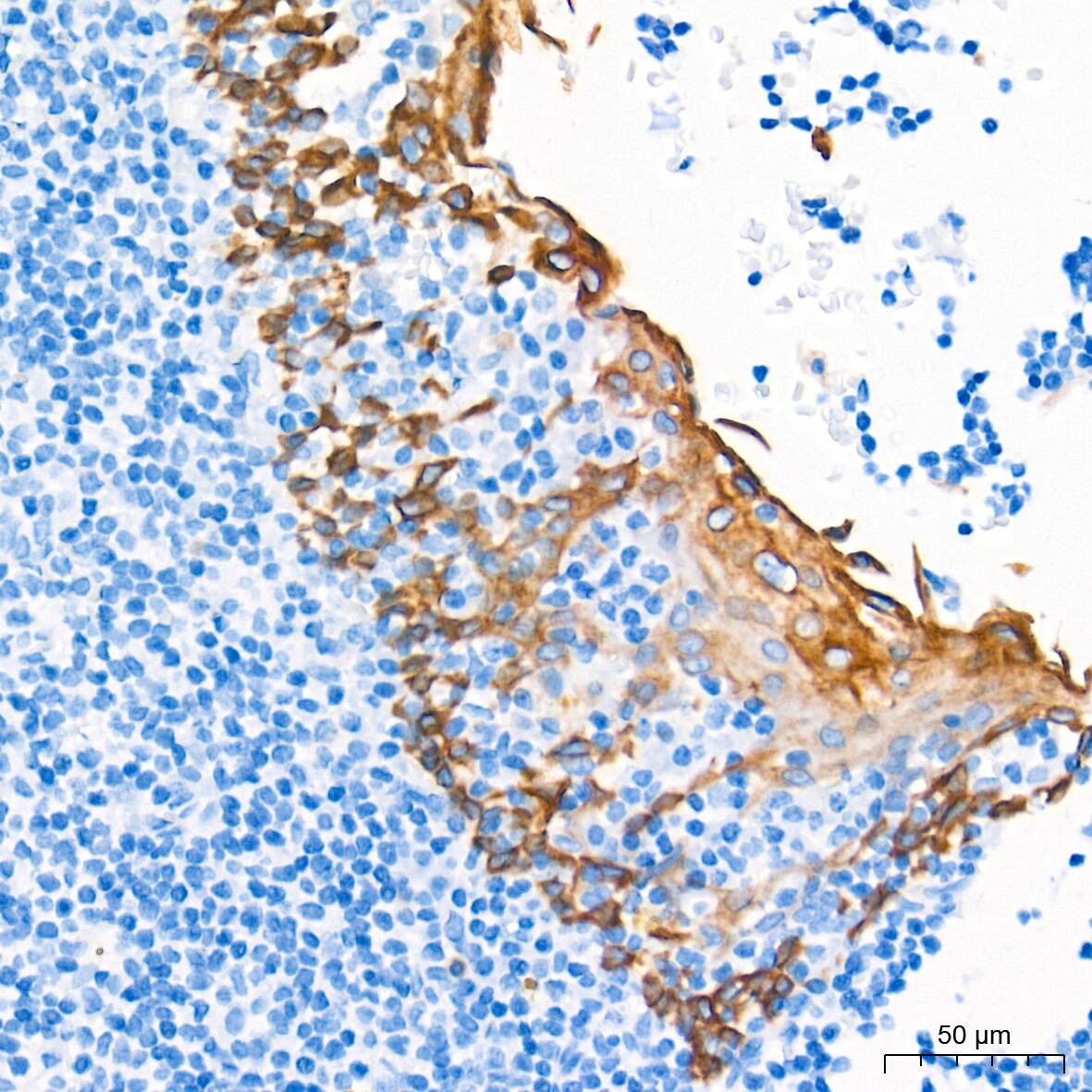 Cytokeratin 16 Antibody (8L6R4)