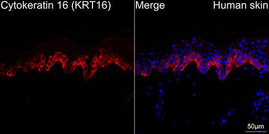 Cytokeratin 16 Antibody (8L6R4)
