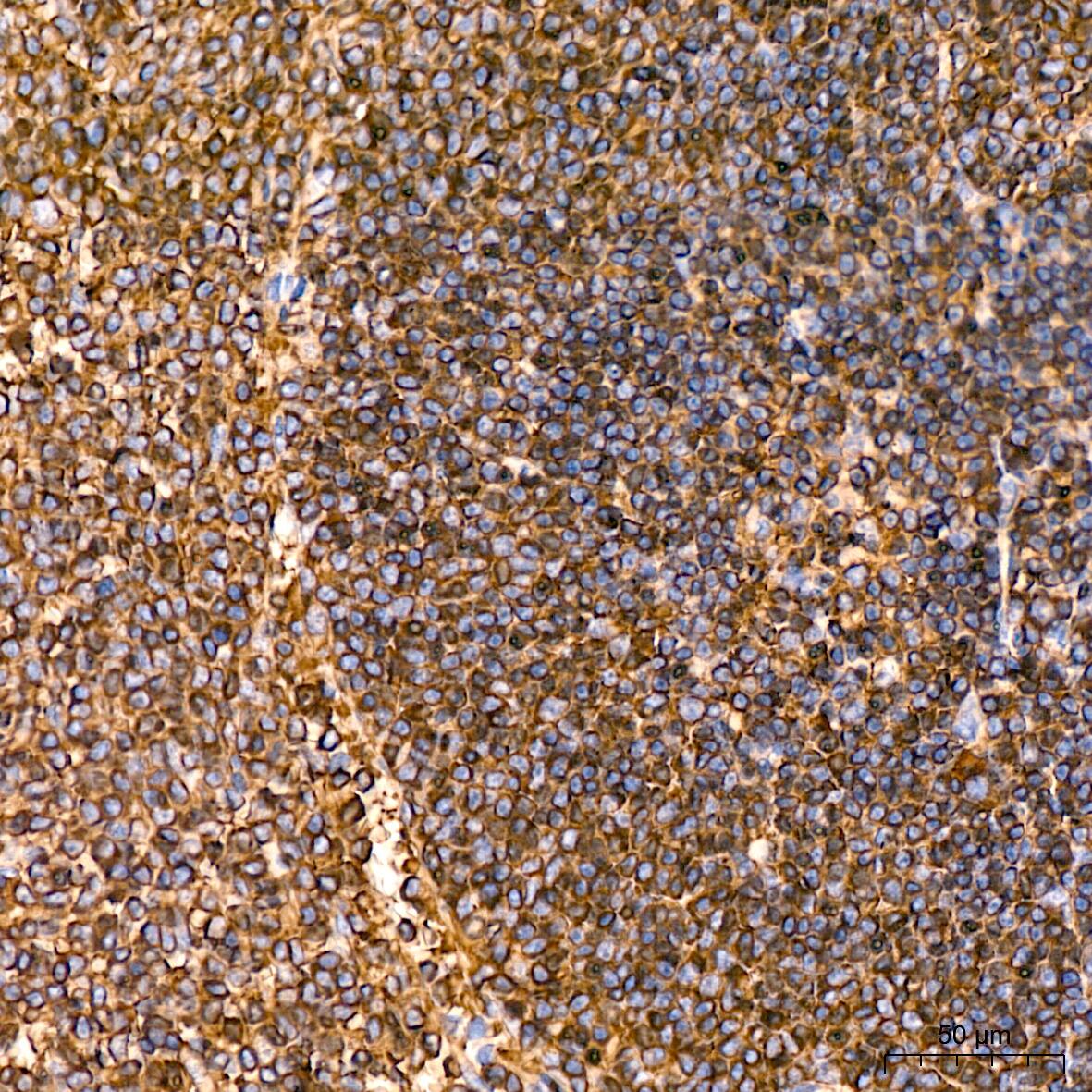 Somatostatin R5/SSTR5 Antibody (4O6N5)