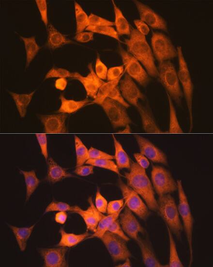 Calpain 1 Antibody (10E6O5)