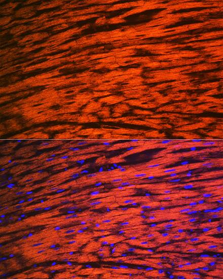 Myosin Light Chain 2 Antibody (5M6Q8)