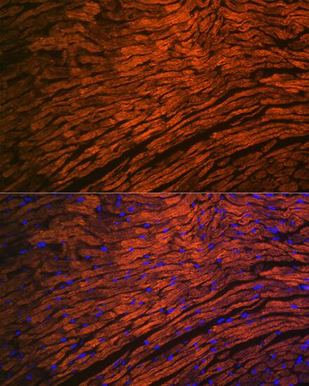Myosin Light Chain 2 Antibody (5M6Q8)