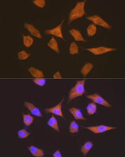 EEF1G Antibody (2E1O7)