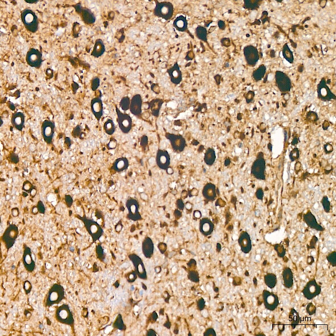 EEF1G Antibody (2E1O7)