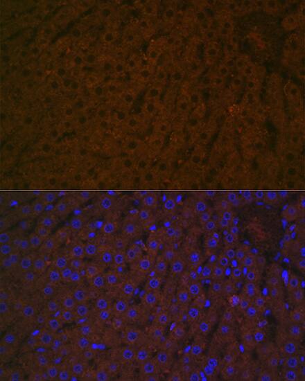 Haptoglobin Antibody (7C1N2)