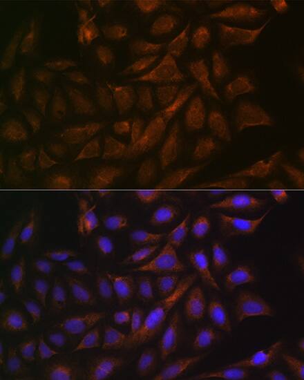 VAMP3/Cellubrevin Antibody (2H8R8)