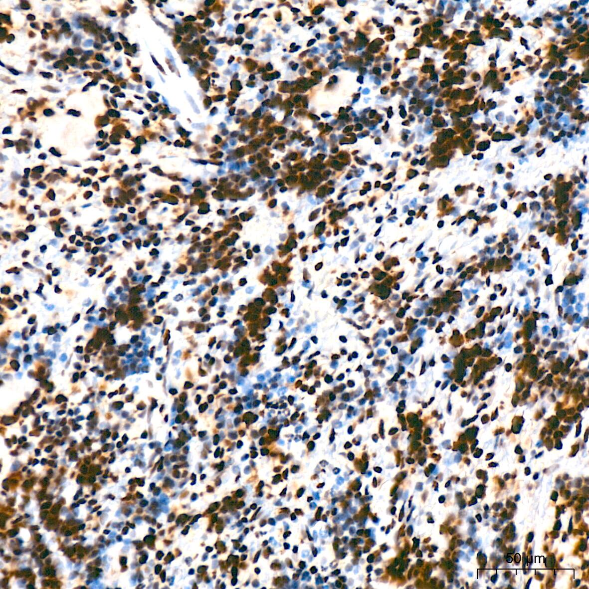 Bub3 Antibody (10G1S6)