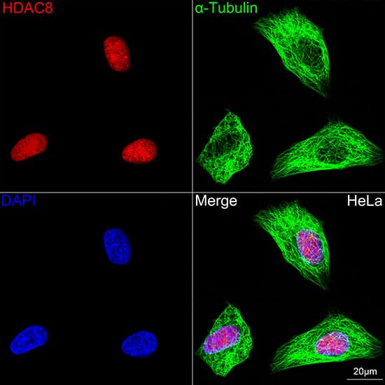 Histone Deacetylase 8/HDAC8 Antibody (1O2Y5)