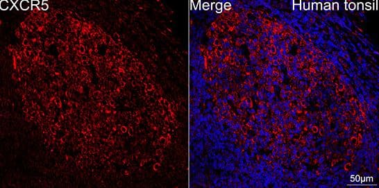 CXCR5 Antibody (9Q10I2)