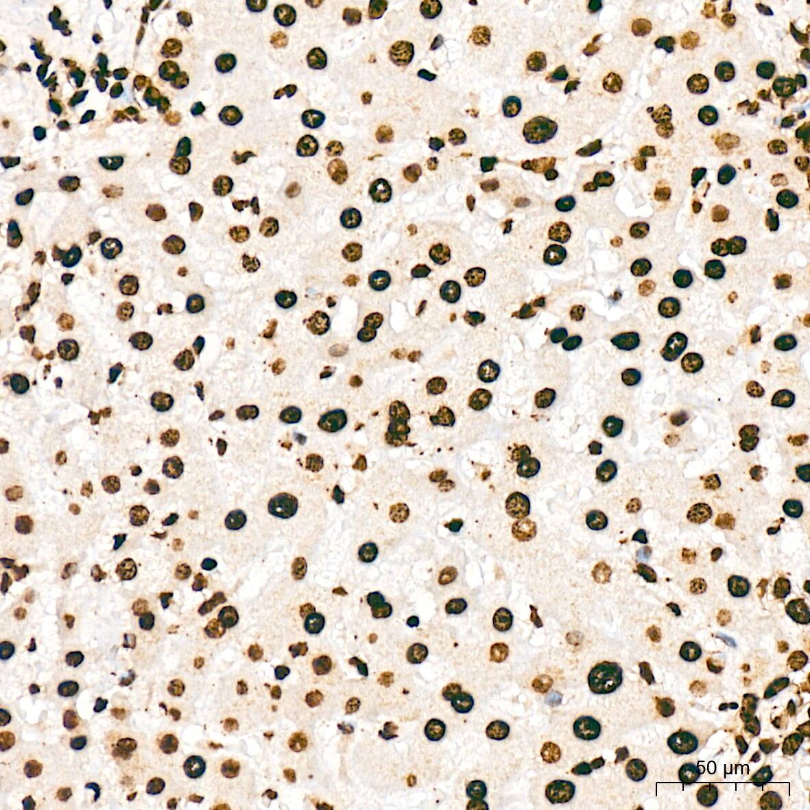 Histone H2AY/macroH2A.1 Antibody (4D2O4)