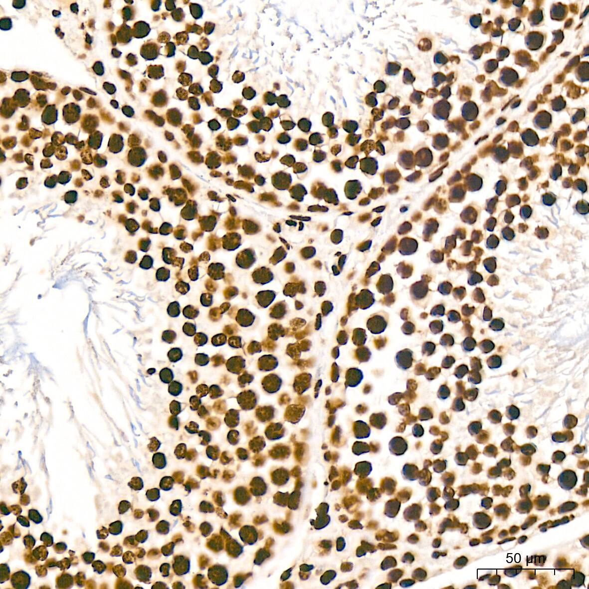 Histone H2AY/macroH2A.1 Antibody (4D2O4)