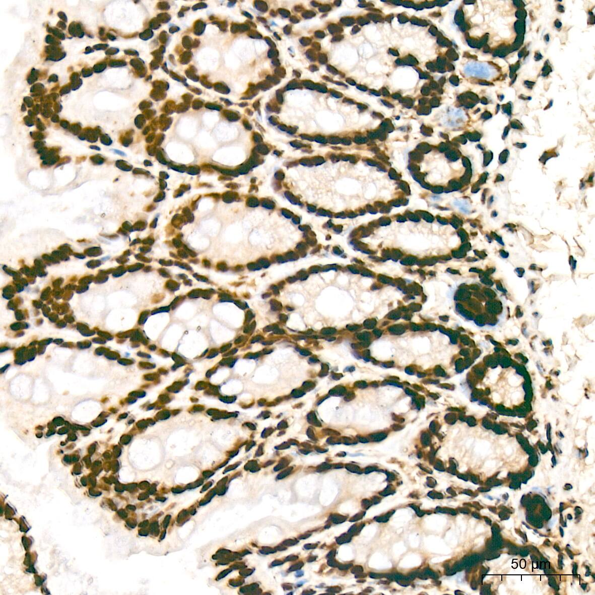 Histone H2AY/macroH2A.1 Antibody (4D2O4)