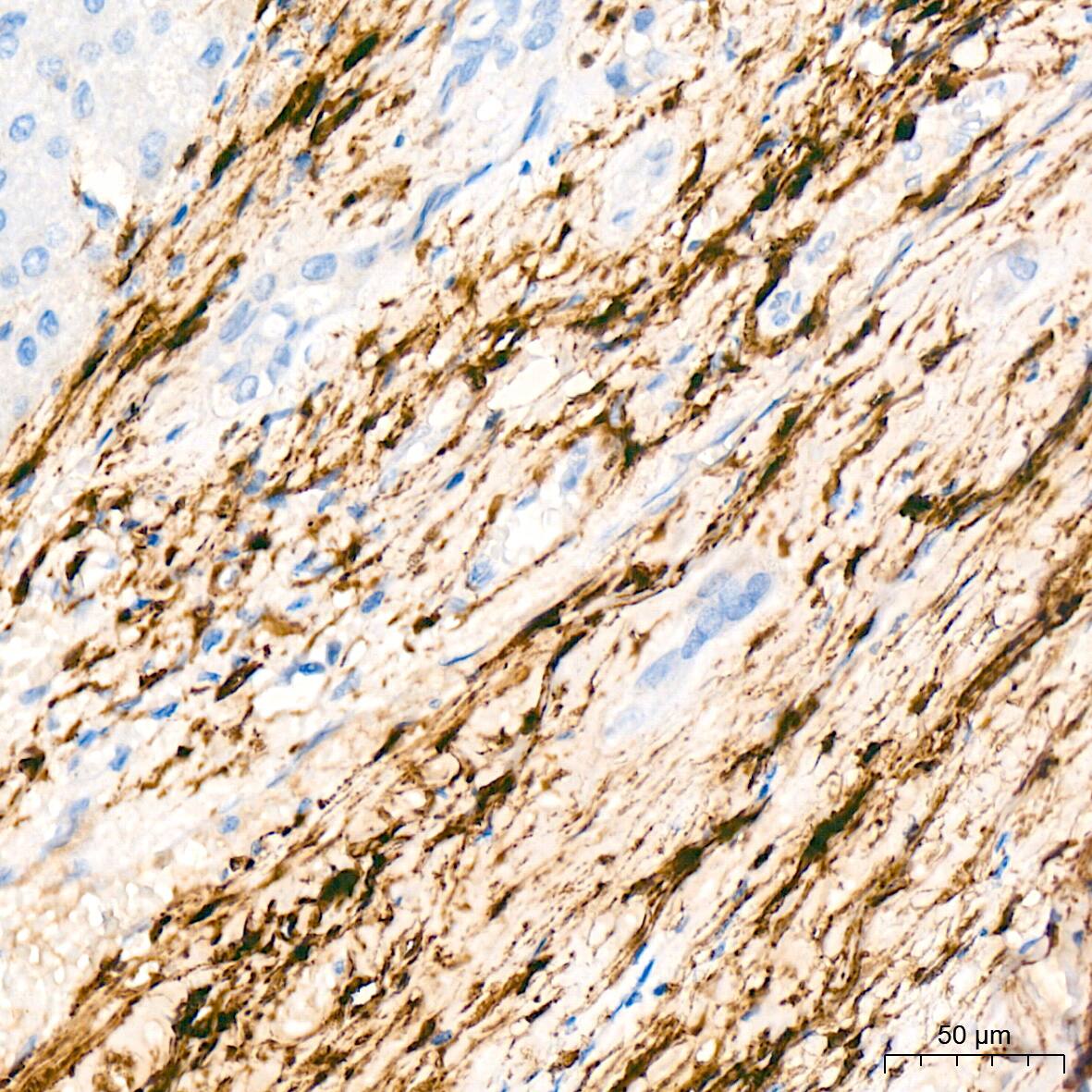 HSP20/HSPB6 Antibody (3J5N1)