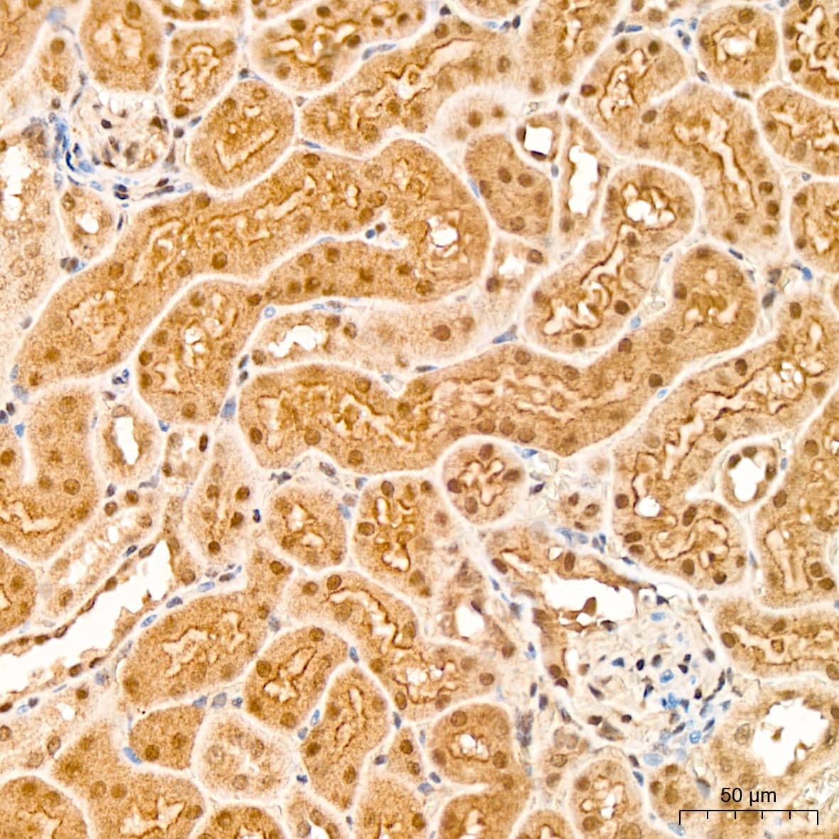 p70 S6 Kinase beta/S6K2 Antibody (5D8F5)