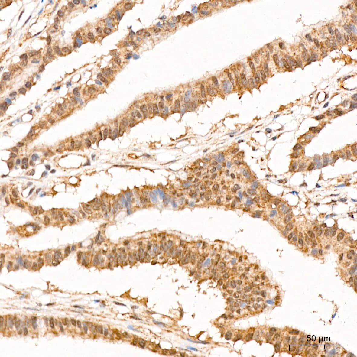 p70 S6 Kinase beta/S6K2 Antibody (5D8F5)