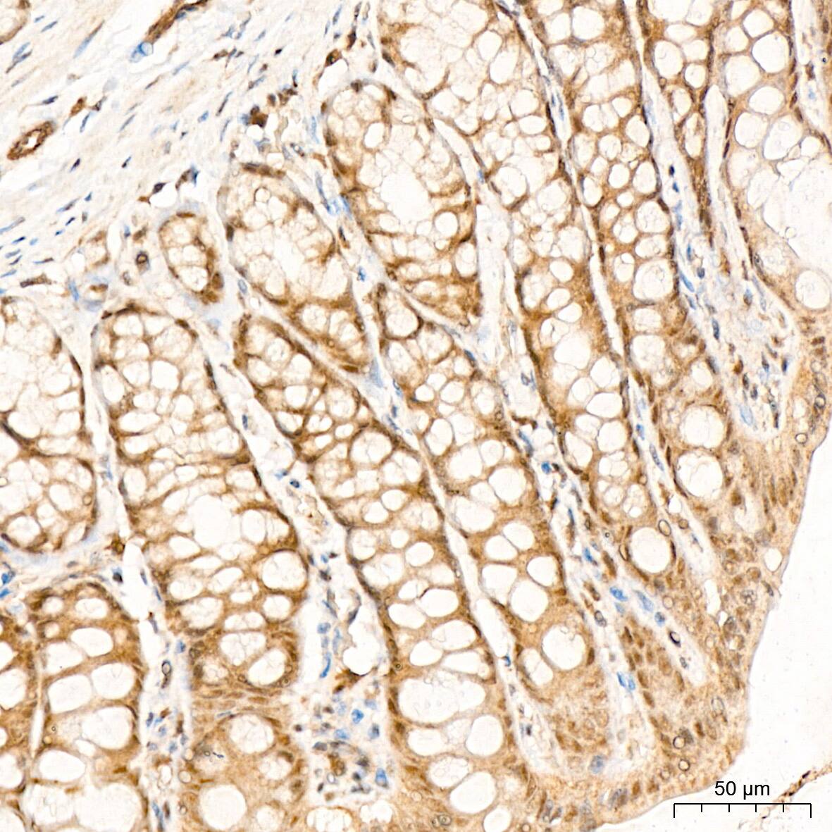 p70 S6 Kinase beta/S6K2 Antibody (5D8F5)