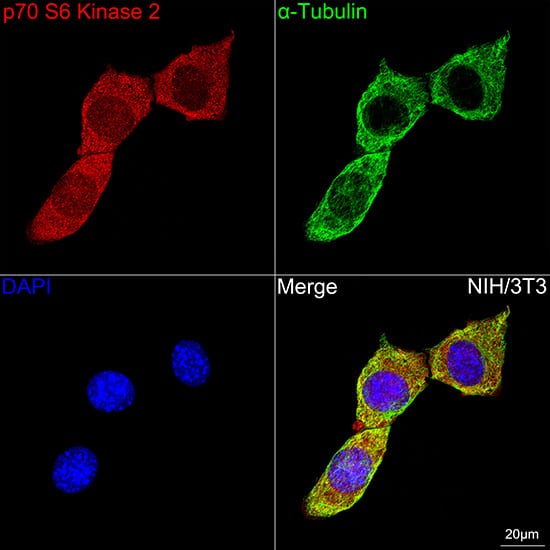 p70 S6 Kinase beta/S6K2 Antibody (5D8F5)