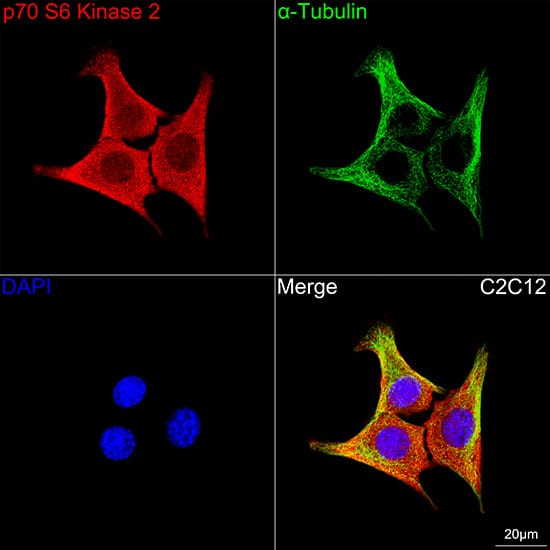 p70 S6 Kinase beta/S6K2 Antibody (5D8F5)