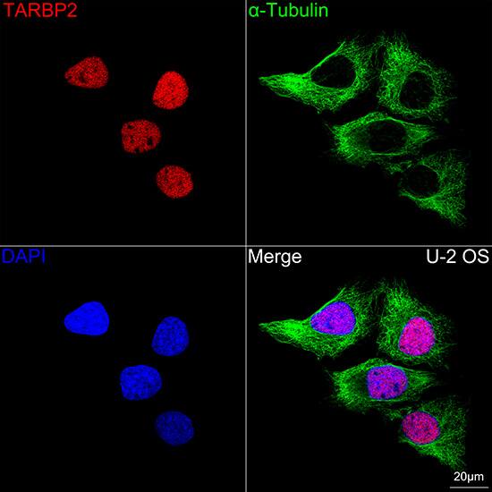 TRBP Antibody (9E6C9)