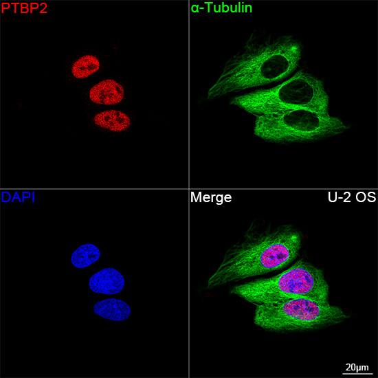 PTBP2 Antibody (10S9P6)