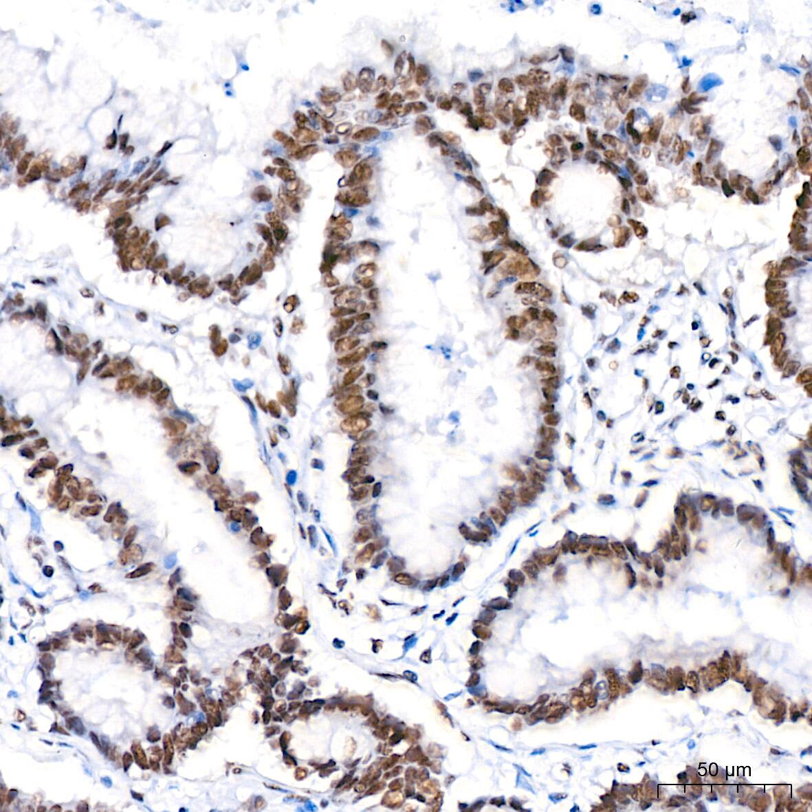 PTBP2 Antibody (10S9P6)