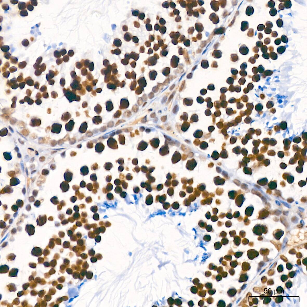 PTBP2 Antibody (10S9P6)