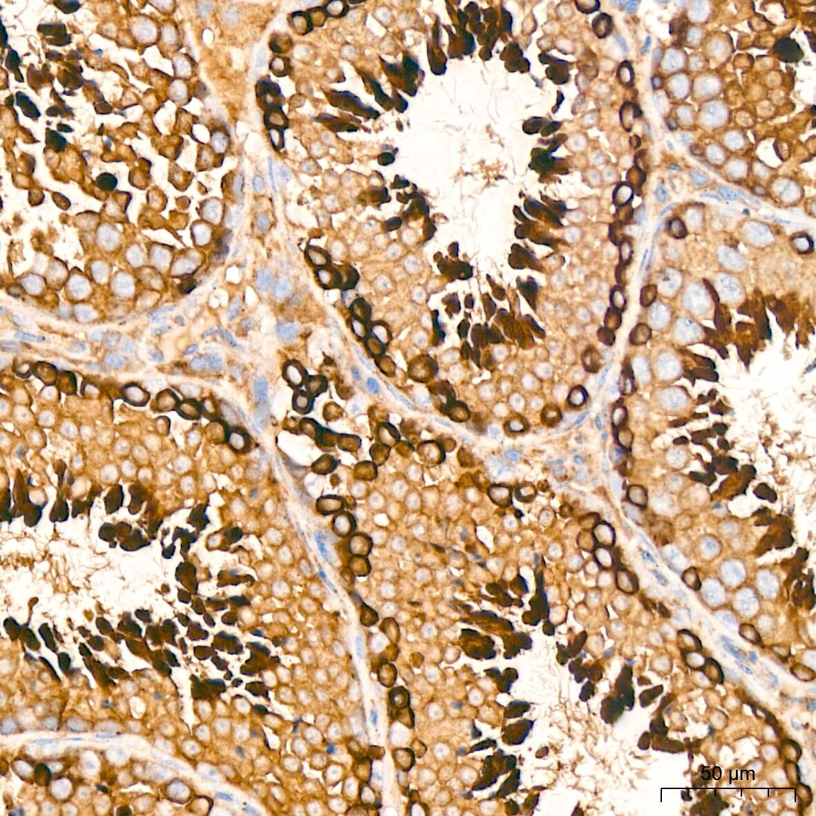 Peroxiredoxin 4 Antibody (9E7V0)