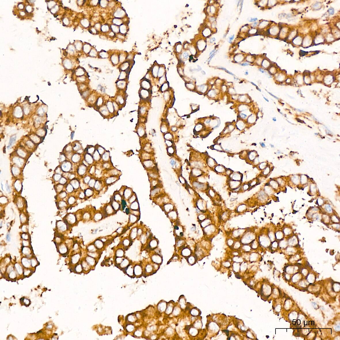 Peroxiredoxin 4 Antibody (9E7V0)